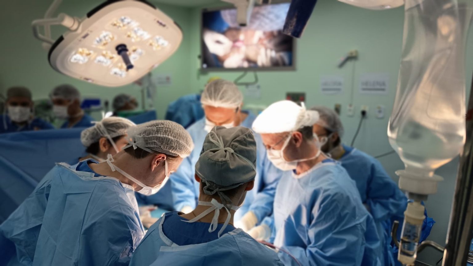 Avanço Crucial: Gêmeas Heloísa e Helena Passam por Terceira Cirurgia de Separação Craniana em Ribeirão Preto