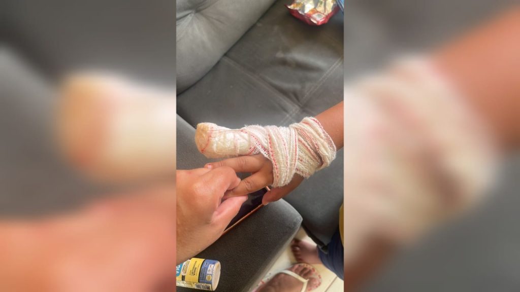 Criança de 4 Anos Sofre Amputação de Dedo em Creche de Sorocaba; Família Pede Apuração