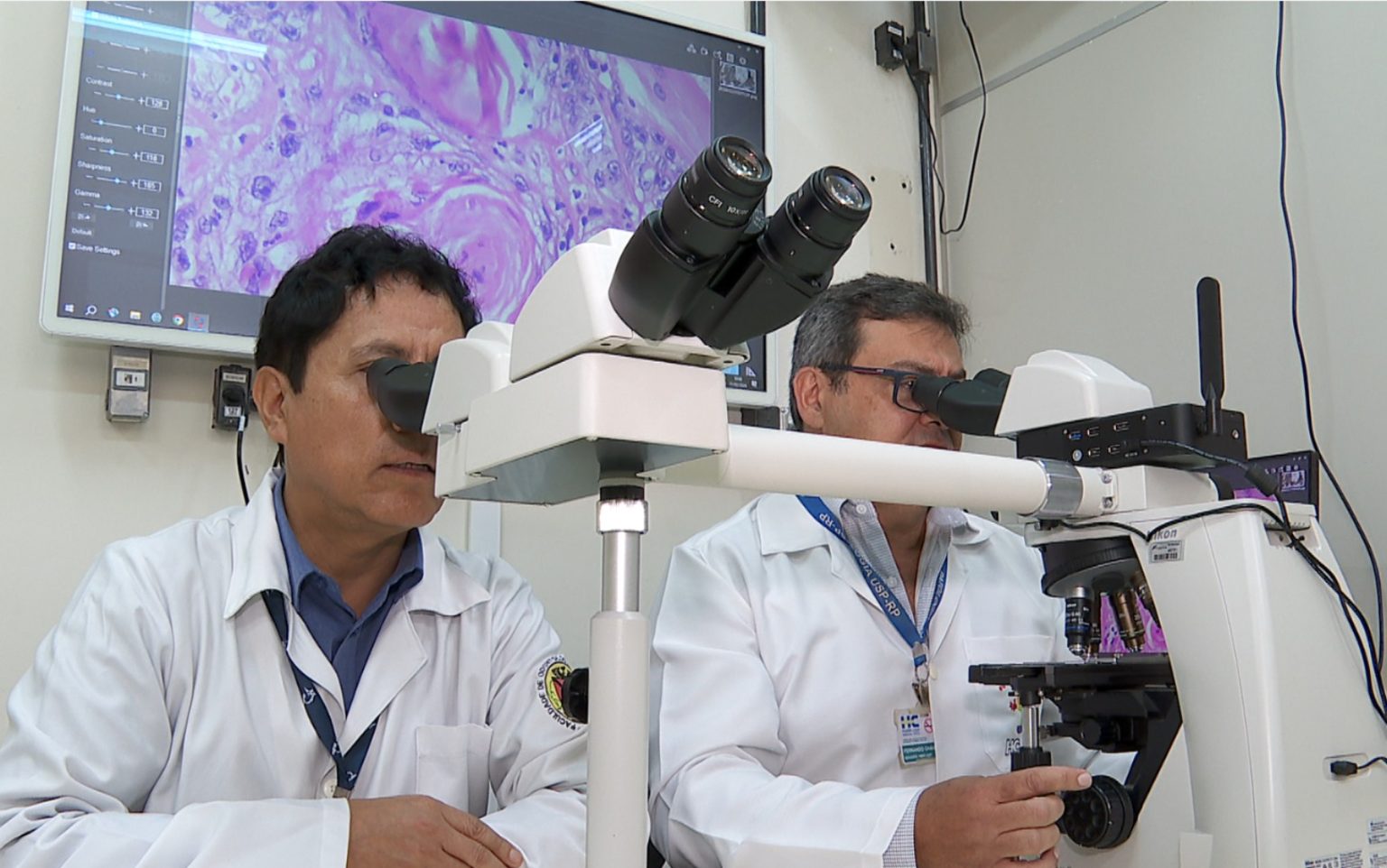 Estudo Pioneiro Revisa Prevalência de Variantes Agressivas em Câncer de Cabeça e Pescoço e Otimiza Tratamentos