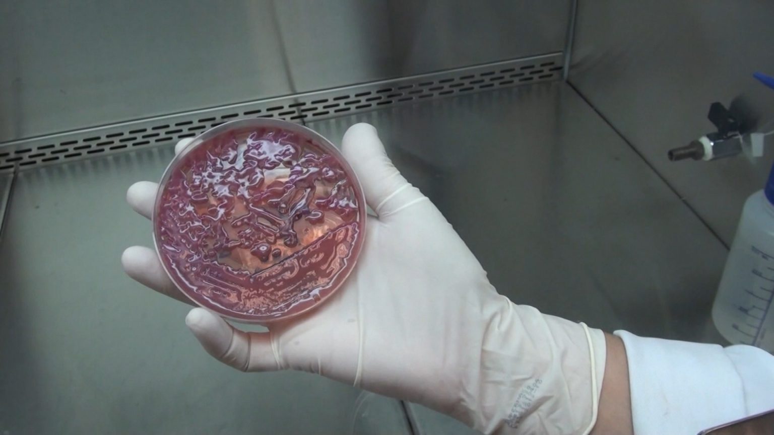 Hospital de Sumaré Identifica Superbactéria KPC em Pacientes: Entenda a Situação e os Protocolos