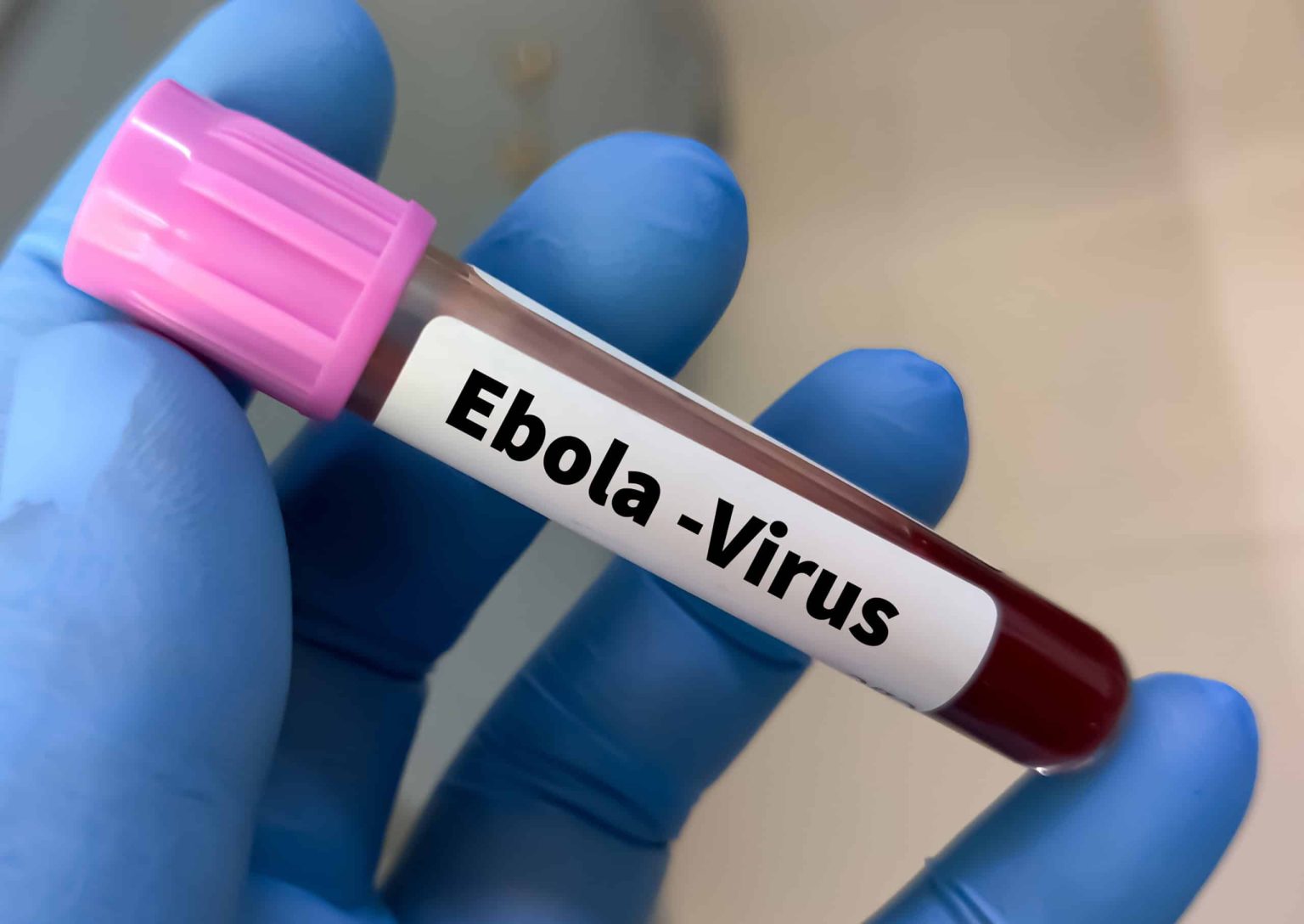 Da Floresta ao Smartphone: A Intrincada Relação Entre Mineração, Desmatamento e a Ascensão do Ebola